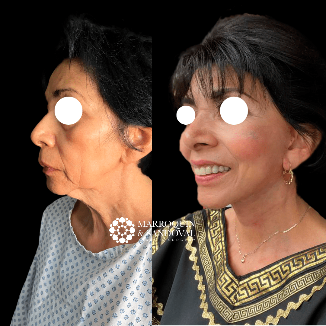 face-img-05
