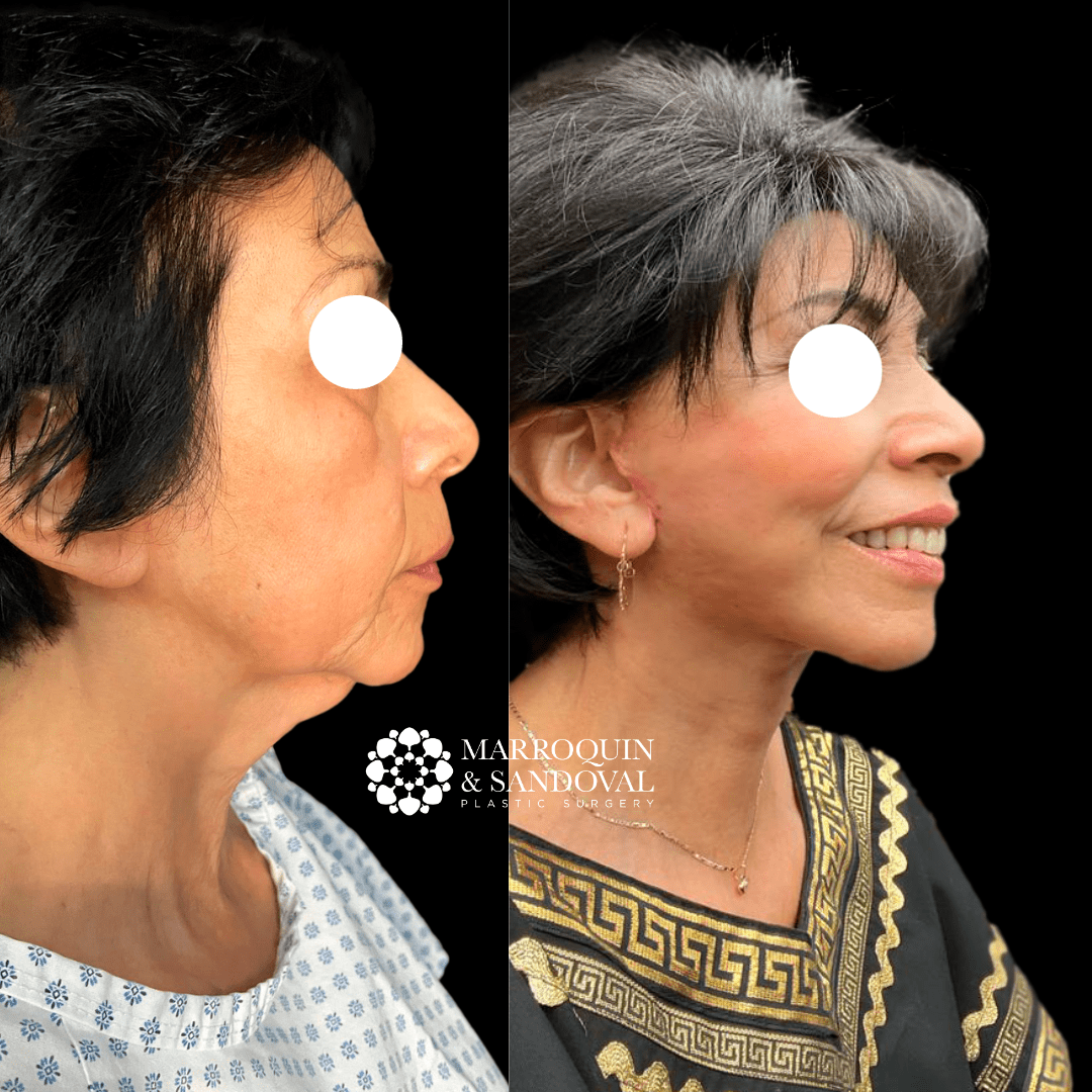 face-img-07